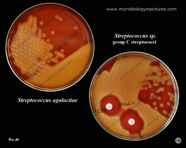 Beta-hemolytic streptococci of group B and C beta-hemolytic streptococci